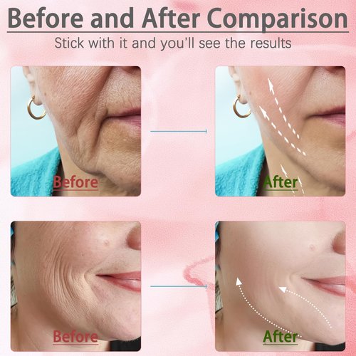 JURP Face Neck Beauty Device, 7 Color Led Face Neck Massager,Multifunctional Facial Skin Care Tool, Ideal for Home Skin Care